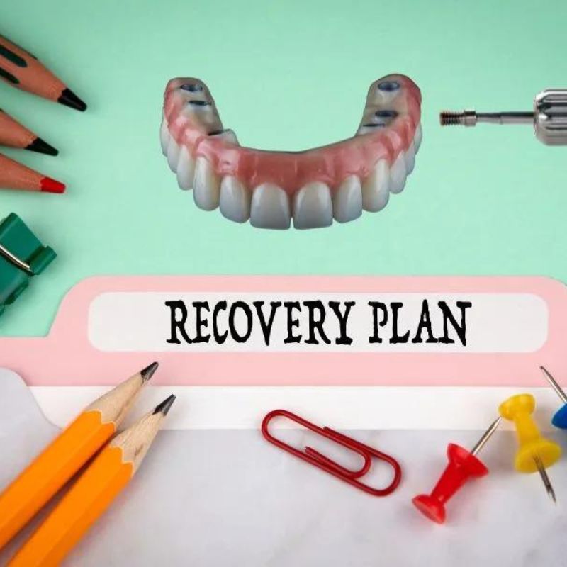 All-On 6 Dental Implants Recovery Time