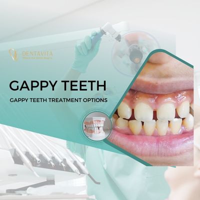 Gappy Teeth