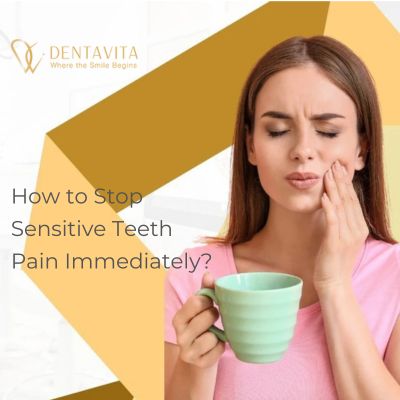 How to Stop Sensitive Teeth Pain Immediately
