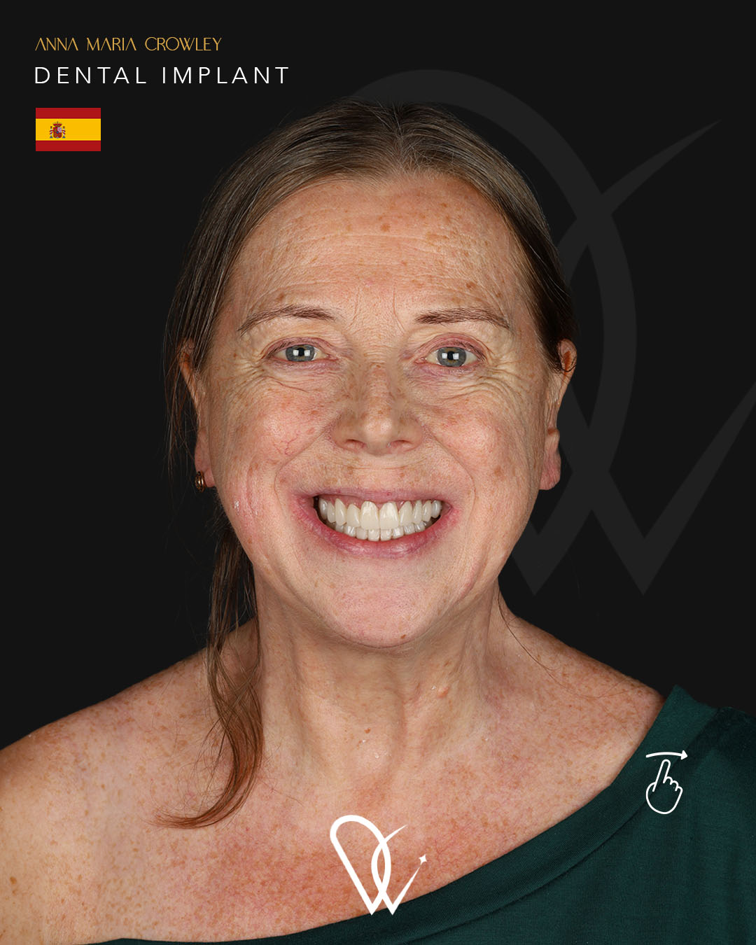 hasta1_1.jpg
